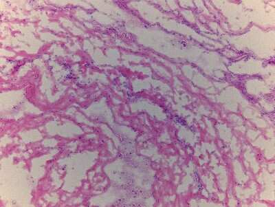 Unknown Brain Cerebral Meninges Tissue Slides (Adult Normal)- Frozen