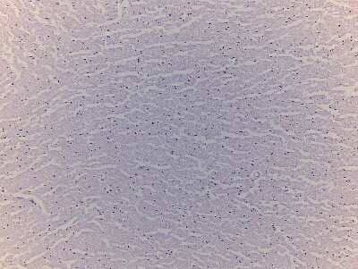 Hematoxylin & Eosin Stain: Brain Corpus Callosum Tissue Slides (Alzheimer's) [NBP2-77824] - Tissue: Human Brain (Corpus Callosum),  Pathology: Alzheimer's Disease