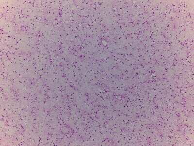 Hematoxylin & Eosin Stain: Brain Frontal Lobe Tissue Slides (Adult Normal) [NBP2-77527] - Human brain: Frontal Lobe, Normal