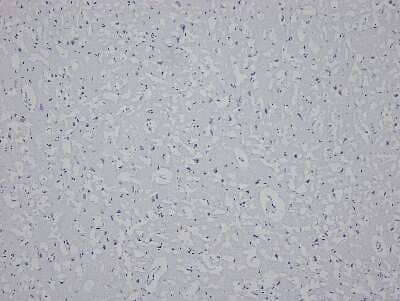 Hematoxylin & Eosin Stain: Brain Frontal Lobe Tissue Slides (Multiple Sclerosis) [NBP2-77988] - Tissue: Human Brain (Frontal Lobe),  Pathology: Multiple Sclerosis