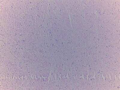 Unknown Brain Midbrain Tissue Slides (Adult Normal)- Paraffin