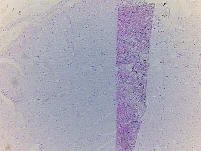 Unknown Brain Optic Nerve Tissue Slides (Adult Normal)- Paraffin