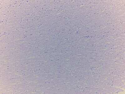 Hematoxylin & Eosin Stain: Brain Pons Tissue Slides (Adult Normal) [NBP2-77771] - Tissue: Human Brain (Pons),  Pathology: Normal