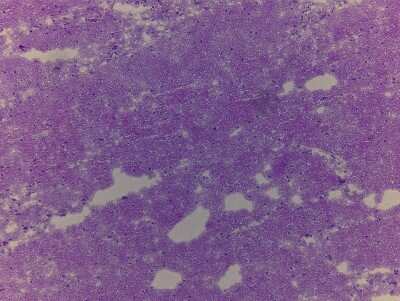 Hematoxylin & Eosin Stain: Brain Pons Tissue Slides (Parkinson's) [NBP2-77697] - Tissue: Human Brain (Pons),  Pathology: Parkinson's Disease