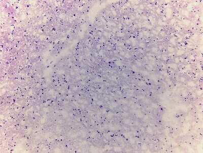 Hematoxylin & Eosin Stain: Brain Precentral Gyrus Tissue Slides (Alzheimer's) [NBP2-77606] - Tissue: Human Brain (Precentral Gyrus),  Pathology: Alzheimer's Disease
