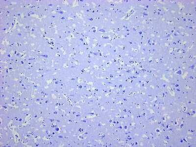 Hematoxylin & Eosin Stain: Brain Precentral Gyrus Tissue Slides (Parkinson's) [NBP2-78007] - Tissue: Human Brain (Precentral Gyrus),  Pathology: Parkinson's Disease