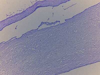 Hematoxylin & Eosin Stain: Brain Artery Tissue Slides (Adult Normal) [NBP2-77747] - Tissue: Human Brain Artery,  Pathology: Normal