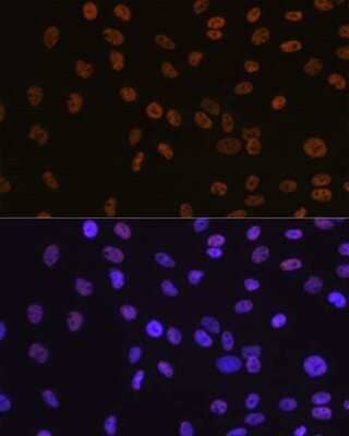 Immunocytochemistry/Immunofluorescence: Brg1 Antibody (4N9C4) [NBP3-15773] - Immunofluorescence analysis of C6 cells using Brg1 antibody (NBP3-15773). Blue: DAPI for nuclear staining.