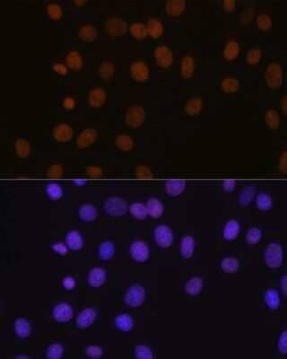 Immunocytochemistry/Immunofluorescence: Brg1 Antibody (4N9C4) [NBP3-15773] - Immunofluorescence analysis of NIH-3T3 cells using Brg1 antibody (NBP3-15773). Blue: DAPI for nuclear staining.