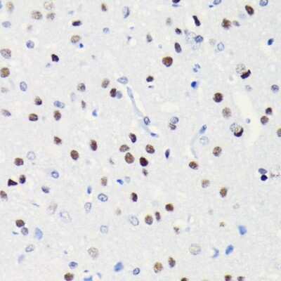 Immunohistochemistry-Paraffin: Brg1 Antibody (4N9C4) [NBP3-15773] - Immunohistochemistry of paraffin-embedded rat brain using Brg1 antibody (NBP3-15773) at dilution of 1:100 (40x lens).Perform microwave antigen retrieval with 10 mM PBS buffer pH 7.2 before commencing with IHC staining protocol.