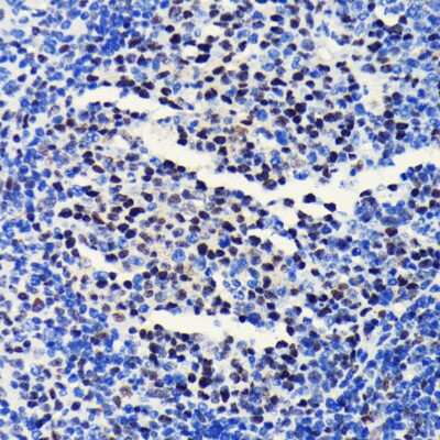 Immunohistochemistry-Paraffin: Brg1 Antibody (4N9C4) [NBP3-15773] - Immunohistochemistry of paraffin-embedded mouse spleen using Brg1 antibody (NBP3-15773) at dilution of 1:100 (40x lens).Perform microwave antigen retrieval with 10 mM PBS buffer pH 7.2 before commencing with IHC staining protocol.