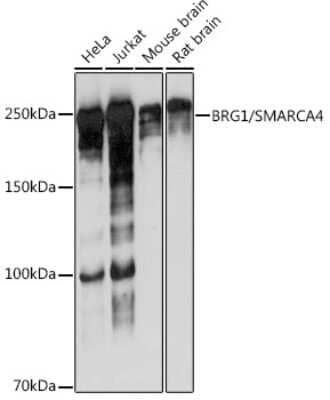 Western Blot: Brg1 Antibody (4N9C4) [NBP3-15773] - Western blot analysis of extracts of various cell lines, using Brg1 antibody (NBP3-15773) at 1:1000 dilution. Secondary antibody: HRP Goat Anti-Rabbit IgG (H+L) at 1:10000 dilution. Lysates/proteins: 25ug per lane. Blocking buffer: 3% nonfat dry milk in TBST. Detection: ECL Basic Kit. Exposure time: 3s.