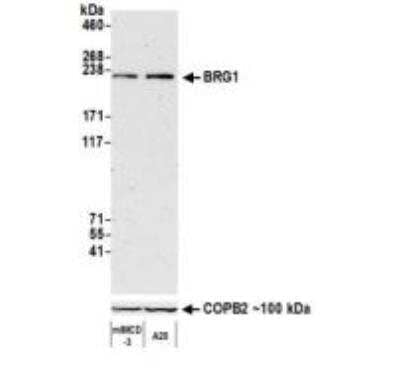 Western Blot: Brg1 Antibody (BLR106H) [NBP3-14696] - Whole cell lysate (50 ug) from mIMCD-3 and A20 cells prepared using NETN lysis buffer. Antibody: Rabbit anti-BRG1 recombinant monoclonal antibody [BLR106H] used at 1:1000. Secondary: HRP-conjugated goat anti-rabbit IgG. Chemiluminescence with an exposure time of 3 minutes. Lower Panel: Rabbit antiCOPB2 antibody.