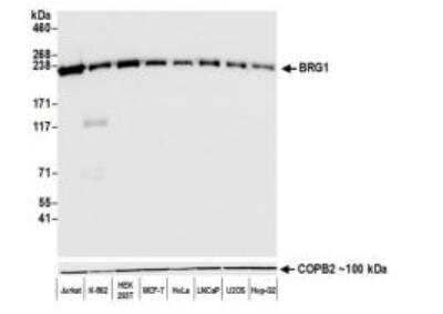 Western Blot: Brg1 Antibody (BLR106H) [NBP3-14696] - Whole cell lysate (50 ug) from Jurkat, K-562, HEK293T, MCF-7, HeLa, LNCaP, U2OS, and Hep-G2 cells prepared using NETN lysis buffer. Antibody: Rabbit anti-BRG1recombinant monoclonal antibody [BLR106H]  used at 1:1000. Secondary: HRP-conjugated goat anti-rabbit IgG.  Chemiluminescence with an exposure time of 30 seconds. Lower Panel: Rabbit antiCOPB2 antibody. 