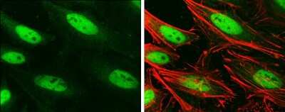 <b>Genetic Strategies Validation. </b>Immunocytochemistry/Immunofluorescence: Brg1 Antibody (GT2712) [NBP3-13537] - Brg1 antibody [GT2712] detects Brg1 protein at nucleus by immunofluorescent analysis. Sample: HeLa cells were fixed in 4% paraformaldehyde at RT for 15 min. Green: Brg1 protein stained by Brg1 antibody [GT2712] (NBP3-13537) diluted at 1:100. Red: phalloidin, a cytoskeleton marker, diluted at 1:50. Blue: Hoechst 33342 staining.