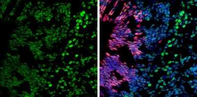 Immunohistochemistry-Frozen: Brg1 Antibody (GT2712) [NBP3-13537] - Brg1 antibody [GT2712] detects Brg1 protein by immunohistochemical analysis. Sample: Frozen-sectioned rat E13.5 brain. Green: Brg1 stained by Brg1 antibody [GT2712] (NBP3-13537) diluted at 1:250. Red: SOX2, stained by SOX2 antibody [N1C3] (NBP1-33766) diluted at 1:500. Blue: Fluoroshield with DAPI.