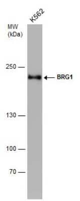 Western Blot: Brg1 Antibody (GT2712) [NBP3-13537] - Whole cell extract (30 ug) was separated by 5% SDS-PAGE, and the membrane was blotted with Brg1 antibody [GT2712] (NBP3-13537) diluted at 1:1000.