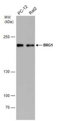 Western Blot: Brg1 Antibody (GT2712) [NBP3-13537] - Various whole cell extracts (30 ug) were separated by 5% SDS-PAGE, and the membrane was blotted with Brg1 antibody [GT2712] (NBP3-13537) diluted at 1:1000.