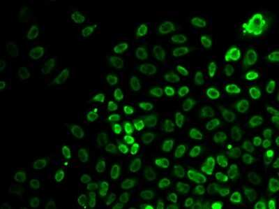 Immunocytochemistry/Immunofluorescence: Brg1 Antibody [NBP2-92957] - Analysis of HeLa cells using Brg1 .