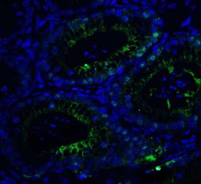 Immunohistochemistry: Brg1 Antibody [NBP2-41270] - Mouse testis tissue with SMARCA4 antibody at 20 ug/ml.