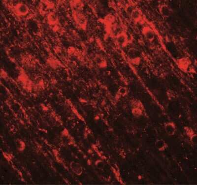 Immunohistochemistry: Brg1 Antibody [NBP2-41270] - Rat brain tissue with BRG1 antibody at 5 ug/mL.