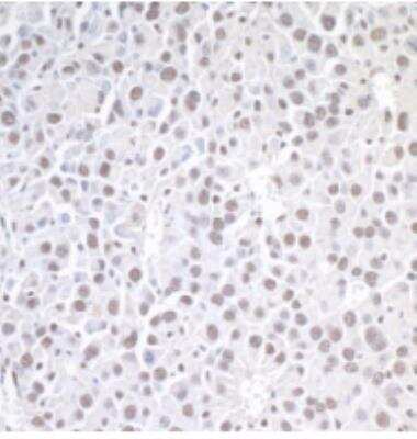 Immunohistochemistry-Paraffin: Brg1 Antibody [NB100-2594] - Section of mouse renal cell carcinoma. Antibody: Affinity purified rabbit antiBRG1/SMARCA4  used at a dilution of 1:1,000 (0.2ug/ml). Detection: DAB