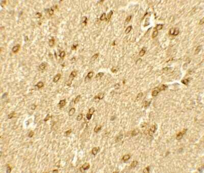 Immunohistochemistry-Paraffin: Brg1 Antibody [NBP2-41270] - Rat brain tissue with BRG1 antibody at 5 ug/mL.