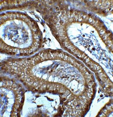 Immunohistochemistry-Paraffin: Brg1 Antibody [NBP2-41270] - Mouse testis tissue with SMARCA4 antibody at 2 ug/ml.