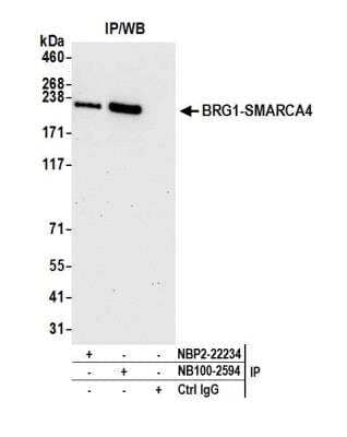 <b>Independent Antibodies Validation. </b>Immunoprecipitation: Brg1 Antibody [NB100-2594] - Detection of human BRG1-SMARCA4 by western blot of immunoprecipitates. Samples: Whole cell lysate (1.0 mg per IP reaction; 20% of IP loaded) from HeLa cells prepared using NETN lysis buffer. Antibodies: Affinity purified rabbit anti-BRG1-SMARCA4 antibody NB100-2594 used for IP at 3 ug per reaction. BRG1-SMARCA4 was also immunoprecipitated by rabbit anti-BRG1-SMARCA4 antibody NBP-22234. For blotting immunoprecipitated BRG1-SMARCA4, NB100-2594 was used at 1 ug/ml. Detection: Chemiluminescence with an exposure time of 30 seconds.