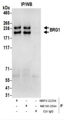 Immunoprecipitation: Brg1 Antibody [NBP2-22234] - Whole cell lysate (1 mg for IP; 20% of IP loaded) from 293T cells.   Antibodies:  NBP2-22234 used for IP at 6 ug/mg lysate.  BRG1 was also immunoprecipitated by rabbit anti-BRG1 antibody NB100-2594.  For blotting immunoprecipitated BRG1, NBP2-22234 was used at 1 ug/ml.    Detection: Chemiluminescence with an exposure time of 30 seconds.