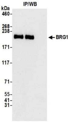 Immunoprecipitation: Brg1 Antibody [NBP3-14696] - Whole cell lysate (1.0 mgper IP reaction; 20% of IP loaded) from HeLa cells preparedusing NETN lysis buffer. Antibodies: Rabbit anti-BRG1recombinant monoclonal antibody  used for IP at 20 ul/mg lysate. BRG1 was alsoimmunoprecipitated by rabbit anti-BRG1 antibody. For blotting immunoprecipitated BRG1, was used at 1:1000. Chemiluminescence withan exposure time of 3 seconds.