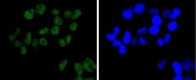 Immunocytochemistry/Immunofluorescence: Brg1 Antibody (SN20-03) - BSA Free [NBP2-74964] - Staining BRG1 in Hela cells (green). The nuclear counter stain is DAPI (blue). Cells were fixed in paraformaldehyde, permeabilized with 0.25% Triton X100/PBS.