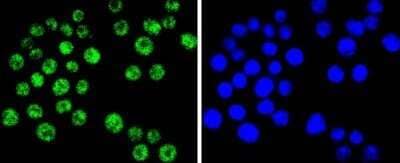 Immunocytochemistry/Immunofluorescence: Brg1 Antibody (SN20-03) - BSA Free [NBP2-74964] - Staining BRG1 in SW480 cells (green). The nuclear counter stain is DAPI (blue). Cells were fixed in paraformaldehyde, permeabilized with 0.25% Triton X100/PBS.