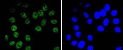 Immunocytochemistry/Immunofluorescence: Brg1 Antibody (SN20-03) - BSA Free [NBP2-74964] - Staining BRG1 in HepG2 cells (green). The nuclear counter stain is DAPI (blue). Cells were fixed in paraformaldehyde, permeabilized with 0.25% Triton X100/PBS.