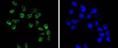 Immunocytochemistry/Immunofluorescence: Brg1 Antibody (SN20-03) - BSA Free [NBP2-74964] - Staining BRG1 in RH-35 cells (green). The nuclear counter stain is DAPI (blue). Cells were fixed in paraformaldehyde, permeabilized with 0.25% Triton X100/PBS.