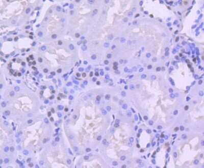 Immunohistochemistry: Brg1 Antibody (SN20-03) - BSA Free [NBP2-74964] - Analysis of paraffin-embedded human kidney tissue using anti-BRG1 antibody. Counter stained with hematoxylin.