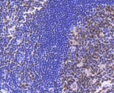 Immunohistochemistry: Brg1 Antibody (SN20-03) - BSA Free [NBP2-74964] - Analysis of paraffin-embedded human tonsil tissue using anti-BRG1 antibody. Counter stained with hematoxylin.