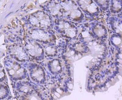 Immunohistochemistry: Brg1 Antibody (SN20-03) - BSA Free [NBP2-74964] - Analysis of paraffin-embedded mouse colon tissue using anti-BRG1 antibody. Counter stained with hematoxylin.