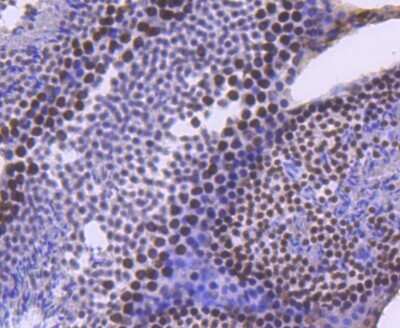 Immunohistochemistry: Brg1 Antibody (SN20-03) - BSA Free [NBP2-74964] - Analysis of paraffin-embedded mouse testis tissue using anti-BRG1 antibody. Counter stained with hematoxylin.