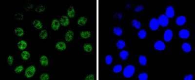 Immunocytochemistry/Immunofluorescence: Brg1 Antibody (SN20-03) [NBP2-67720] - Staining BRG1 in HepG2 cells (green). The nuclear counter stain is DAPI (blue). Cells were fixed in paraformaldehyde, permeabilised with 0.25% Triton X100/PBS.