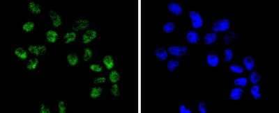 Immunocytochemistry/Immunofluorescence: Brg1 Antibody (SN20-03) [NBP2-67720] - Staining BRG1 in RH-35 cells (green). The nuclear counter stain is DAPI (blue). Cells were fixed in paraformaldehyde, permeabilised with 0.25% Triton X100/PBS.