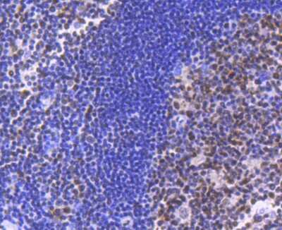 Immunohistochemistry-Paraffin: Brg1 Antibody (SN20-03) [NBP2-67720] - Analysis of paraffin-embedded human tonsil tissue using anti-BRG1 antibody. Counter stained with hematoxylin.