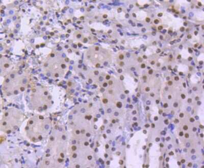 Immunohistochemistry-Paraffin: Brg1 Antibody (SN20-03) [NBP2-67720] - Immunohistochemical analysis of paraffin-embedded mouse kidney tissue using anti-Brg1 antibody. The section was pre-treated using heat mediated antigen retrieval with Tris-EDTA buffer (pH 8.0-8.4) for 20 minutes. The tissues were blocked in 5% BSA for 30 minutes at room temperature, washed with ddH2O and PBS, and then probed with the primary antibody (1/50) for 30 minutes at room temperature. The detection was performed using an HRP conjugated compact polymer system. DAB was used as the chromogen. Tissues were counterstained with hematoxylin and mounted with DPX.