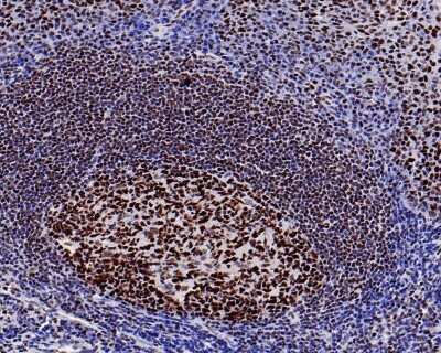 Immunohistochemistry-Paraffin: Brg1 Antibody (SN20-03) [NBP2-67720] - Analysis of paraffin-embedded human tonsil tissue with Rabbit anti-Brg1 antibody washed with ddH2O and PBS, and then probed with the primary antibody  at 1/500 dilution for 1 hour at room temperature. The detection was performed using an HRP conjugated compact polymer system. DAB was used as the chromogen. Tissues were counterstained with hematoxylin and mounted with DPX.