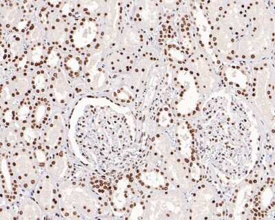 Immunohistochemistry-Paraffin: Brg1 Antibody (SN20-03) [NBP2-67720] - Analysis of paraffin-embedded human kidney tissue with Rabbit anti-Brg1 antibody washed with ddH2O and PBS, and then probed with the primary antibody at 1/500 dilution for 1 hour at room temperature. The detection was performed using an HRP conjugated compact polymer system. DAB was used as the chromogen. Tissues were counterstained with hematoxylin and mounted with DPX.