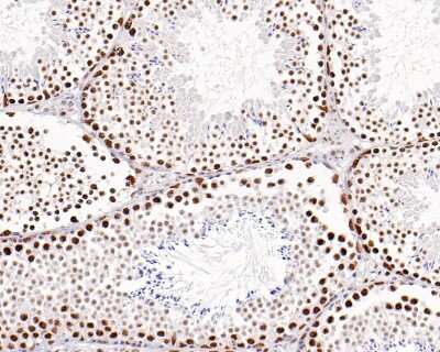 Immunohistochemistry-Paraffin: Brg1 Antibody (SN20-03) [NBP2-67720] - Analysis of paraffin-embedded mouse testis tissue with Rabbit anti-Brg1 antibody washed with ddH2O and PBS, and then probed with the primary antibody  at 1/500 dilution for 1 hour at room temperature. The detection was performed using an HRP conjugated compact polymer system. DAB was used as the chromogen. Tissues were counterstained with hematoxylin and mounted with DPX.