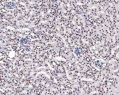 Immunohistochemistry-Paraffin: Brg1 Antibody (SN20-03) [NBP2-67720] - Analysis of paraffin-embedded mouse kidney tissue using anti-Brg1 antibody. The section was pre-treated using heat mediated antigen retrieval with Tris-EDTA buffer (pH 9.0) for 2 minutes.The tissues were blocked in 5% BSA for 30 minutes at room temperature, washed with ddH2O and PBS, and then probed with the primary antibody (1/50) for 30 minutes at room temperature. The detection was performed using an HRP conjugated compact polymer system. DAB was used as the chromogen. Tissues were counterstained with hematoxylin and mounted with DPX.