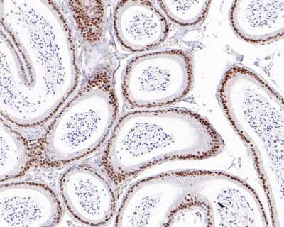 Immunohistochemistry-Paraffin: Brg1 Antibody (SN20-03) [NBP2-67720] - Analysis of paraffin-embedded mouse epididymis tissue with Rabbit anti-Brg1 antibody washed with ddH2O and PBS, and then probed with the primary antibody  at 1/500 dilution for 1 hour at room temperature. The detection was performed using an HRP conjugated compact polymer system. DAB was used as the chromogen. Tissues were counterstained with hematoxylin and mounted with DPX.