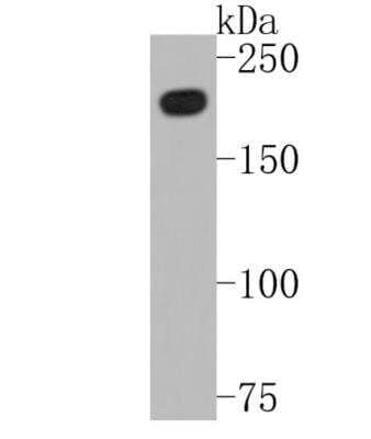 Western Blot: Brg1 Antibody (SN20-03) [NBP2-67720] - Analysis of BRG1 on HepG2 cell lysates. Proteins were transferred to a PVDF membrane and blocked with 5% BSA in PBS for 1 hour at room temperature. The primary antibody (1/500) was used in 5% BSA at room temperature for 2 hours. Goat Anti-Rabbit IgG - HRP Secondary Antibody at 1:5,000 dilution was used for 1 hour at room temperature.