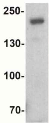 Western Blot: Brg1 Antibody [NBP2-41270] - Analysis of SMARCA4 in SK-N-SH cell lysate with SMARCA4 antibody at 1 ug/ml.